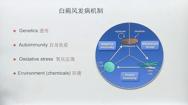 白癜风是如何发生的？——探究白癜风的病因和发病机制