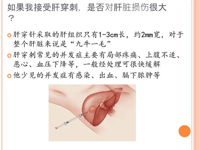 肝穿刺检查费用是多少？如何做肝穿刺