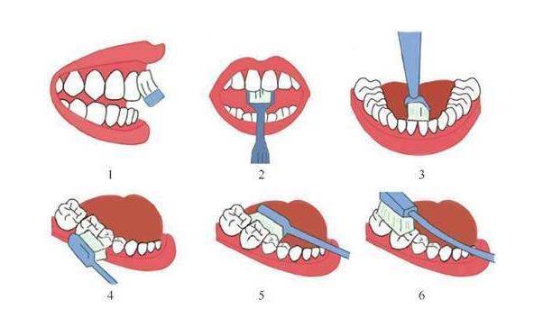 为什么怎样刷牙才干净？如何刷牙才干静