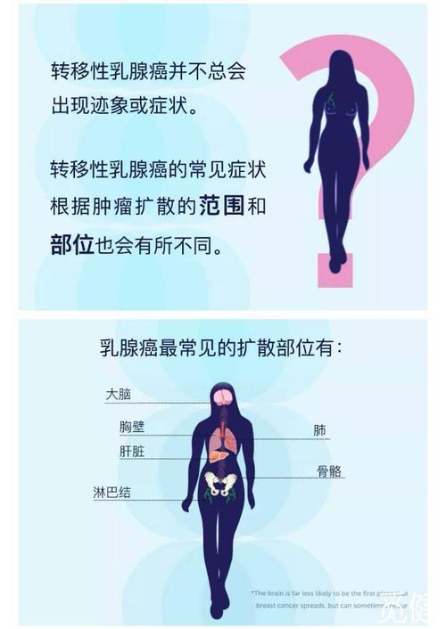 什么是乳腺癌转移？癌细胞是怎么转移？乳腺癌如何判断转移