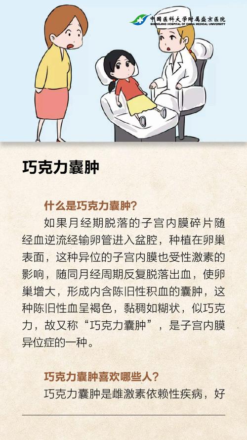 巧克力囊肿一般多久会复发？巧克力囊肿如何不复发