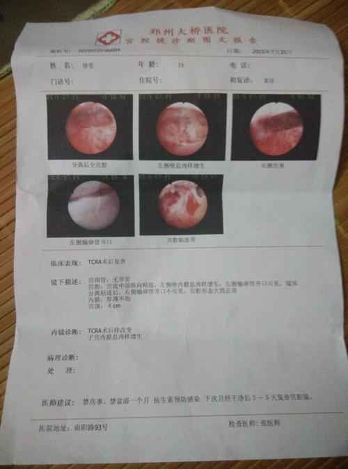 做什么检查可以查出子宫内膜有没有炎症和轻微的粘连？子宫粘连如何检查