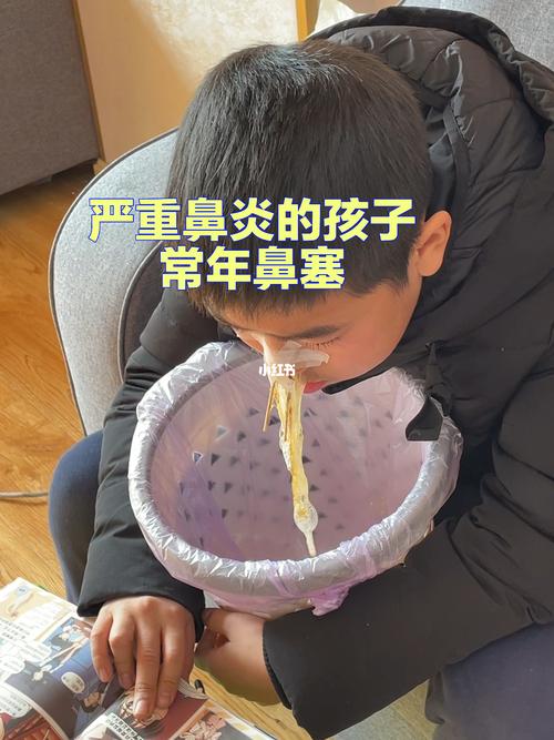 双组鼻窦炎，鼻涕倒流怎么治？小儿鼻窦炎流涕如何止住鼻涕