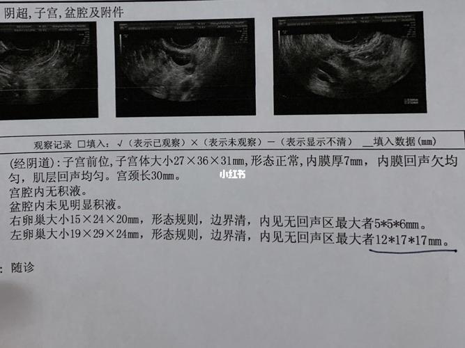 卵泡怎么检查？医院里如何进行卵泡测