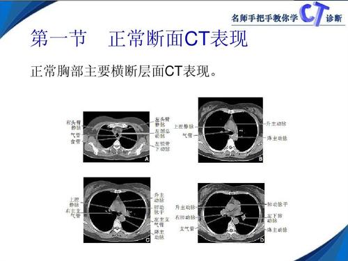 初学者该如何学会看X片和CT片？如何看懂ct片子