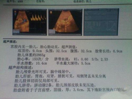 怀孕39周怎么知道男女呢？可以用什么方法查呢？b超可以吗？如何看b超结果知道男女性别