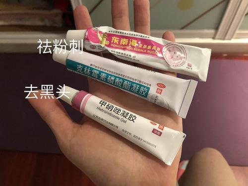 闭合性粉刺用什么药膏?闭合性粉刺怎么治疗？如何治粉刺