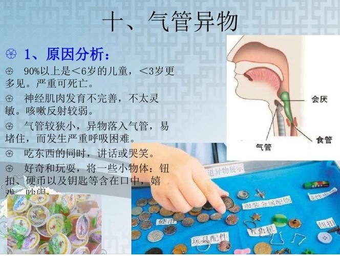 孩子气管异物如何治疗？如何判断气管有异物 小孩