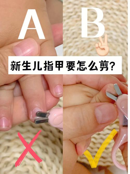 婴儿指甲护理方法？如何修剪宝宝的指甲比较好看