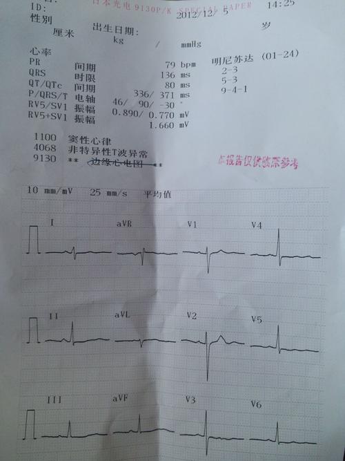 体检时心电图不正常该怎么办？如何使心电图不正常