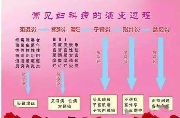 妇科炎症做两癌检查会呈阳性吗？如何区分宫颈炎和阴道炎