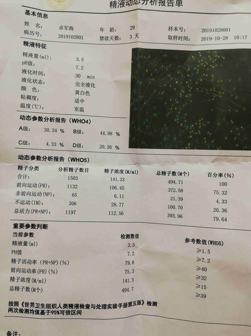 精子常规检查正常值是多少？如何检测精子质量