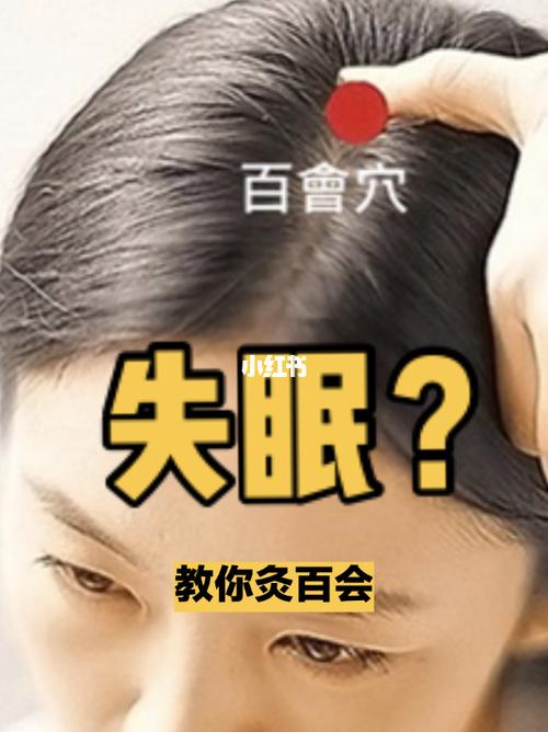 艾灸怎么冶美尼尔综合症？如何灸百会