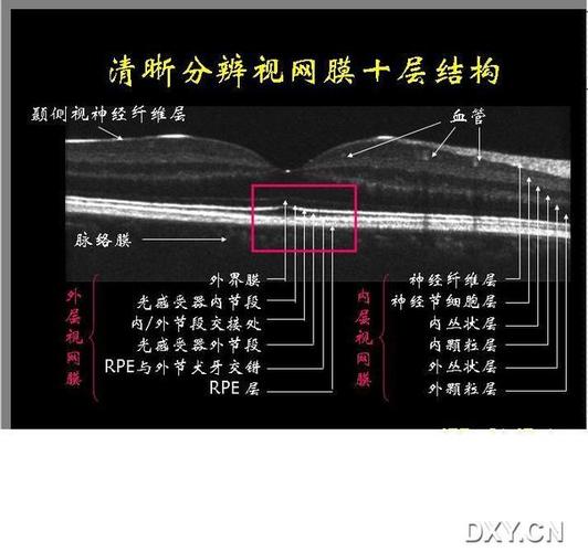 视网膜成像参数规律？视网膜变薄自己如何知道