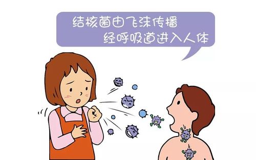 结核为什么咳嗽？肺结核是如何引起的