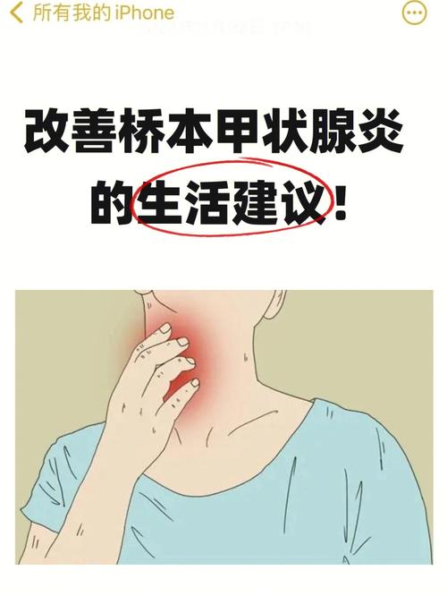 桥本氏甲状腺炎是什么？桥本甲状腺炎如何治疗