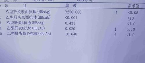 体检可以查出乙肝吗？如何检查是否感染乙肝