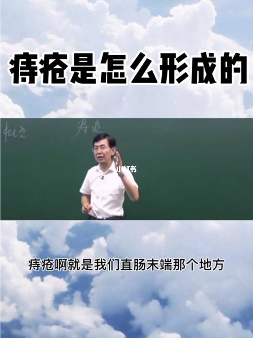 痔疮会是怎么形成的？痔疮是如何形成的