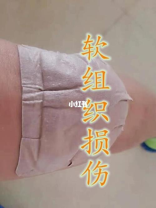 软组织损伤多久能好？软组织损伤如何治疗