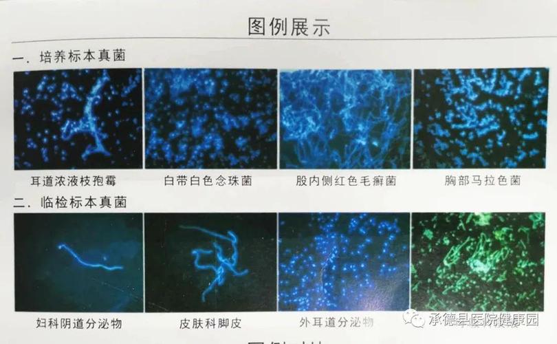 真菌染色常用方法？如何鉴定真菌