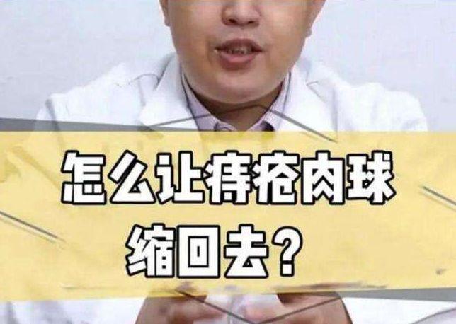 外痔该怎么治？得了外痔疮如何治疗