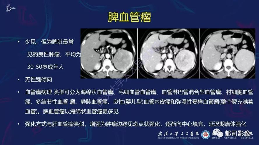 脾里面长血管瘤要怎么办？脾脏血管瘤如何治疗