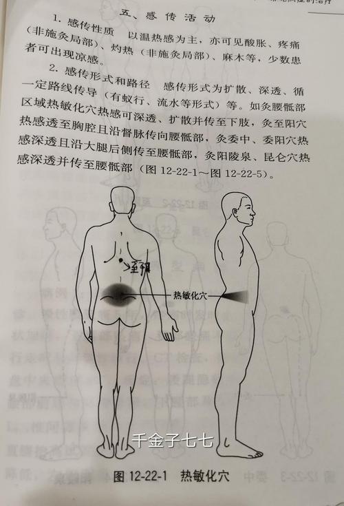 腰椎管狭窄怎么艾灸？椎管狭窄如何锻炼