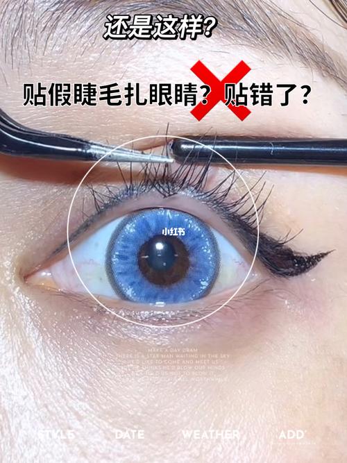 睫毛扎眼怎么解决？眼球让扎了如何冶疗