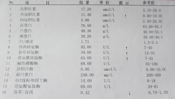 办健康证查肝功能哪方面的？如何确诊自勉肝