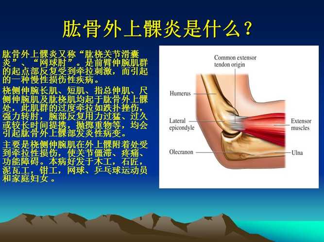 肱骨内上髁炎不能吃什么？弘骨外上髁炎如何治疗