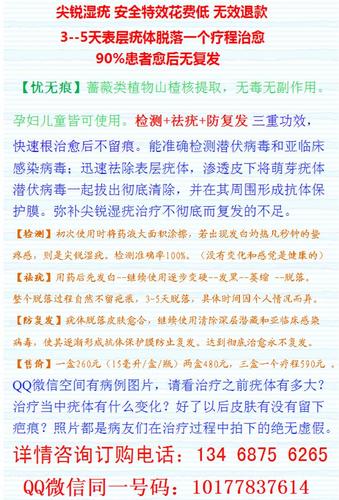 尖锐湿疣的治疗方法是什么？女性尖锐疣如何治疗好