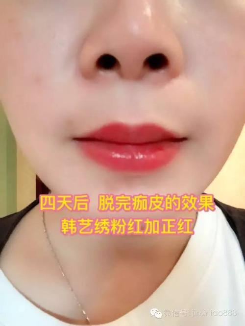 漂唇补色后如何护理？飘唇如何避免感染