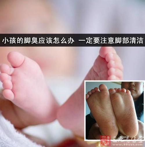 小孩脚臭是什么原因？小孩子脚臭如何去除