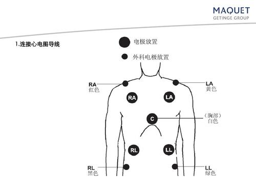 心电图机怎么设置？如何贴心电图电极片