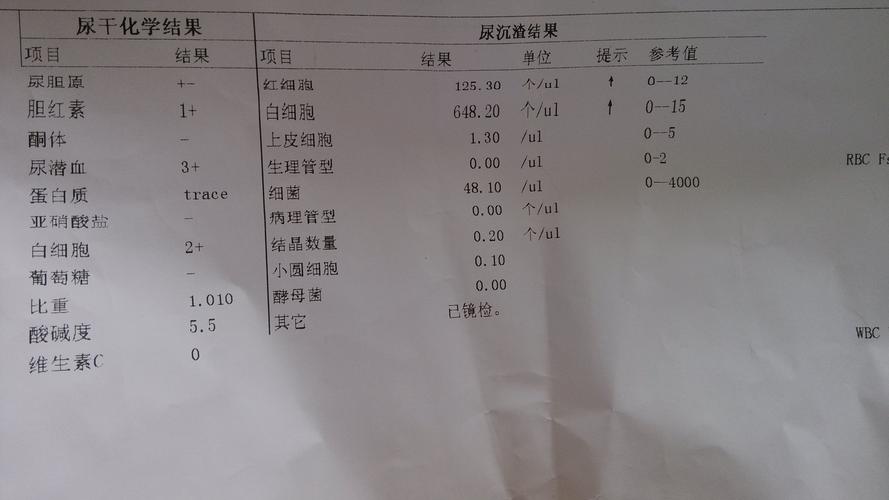 尿常规检查能查出尿路感染吗？尿路感染如何分辨种类