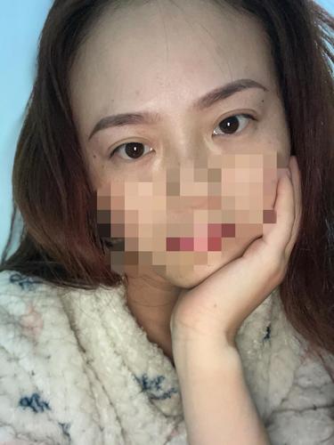 纹眉失败眉尾一边高一边底怎么补就？如何辨解纹眉失败