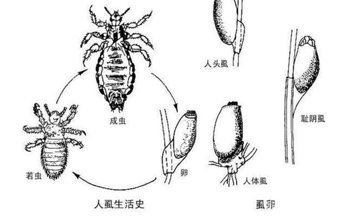 虱子长什么样？如何判断头上有阴虱