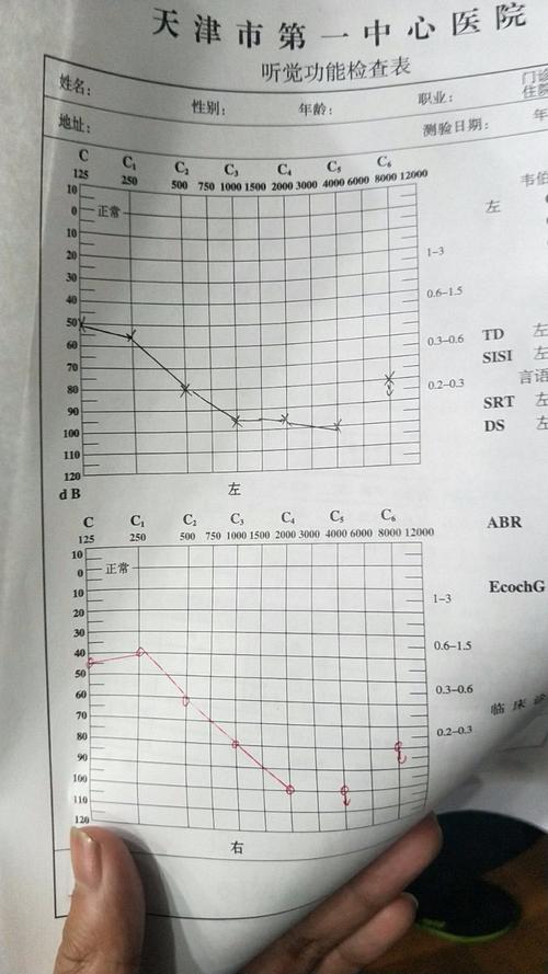 小孩听力50分贝严重吗？如何判断小孩子听力受损