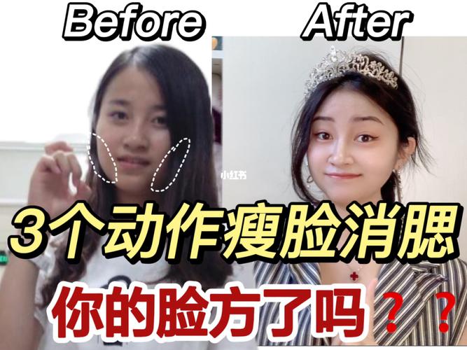 怎么减小腮帮子？如何瘦脸 瘦腮帮