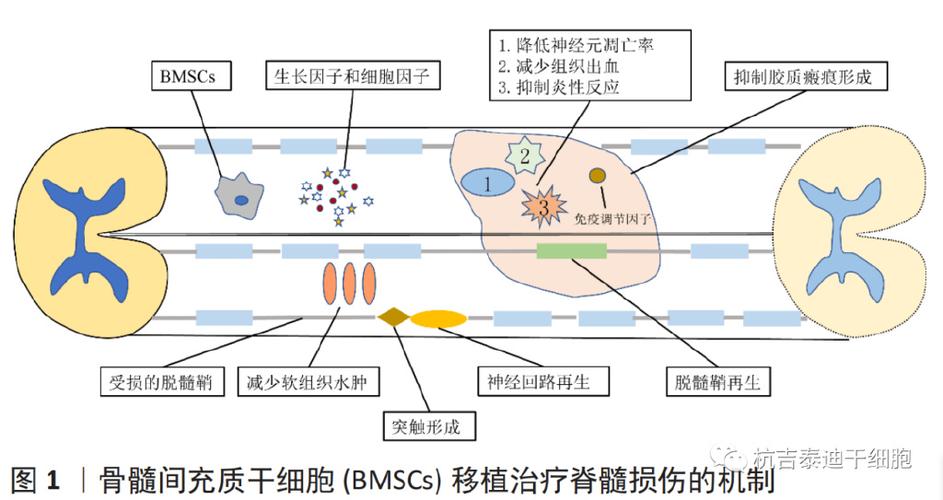 干细胞治疗脊髓损伤效果好吗？如何有效治疗脊髓损伤