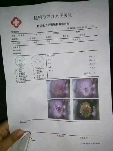 宫颈糜烂3度怎么治？宫颈糜烂3如何治疗