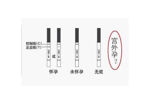 宫外孕可以用试纸测出来吗？如何用试纸检查阴道酸碱性