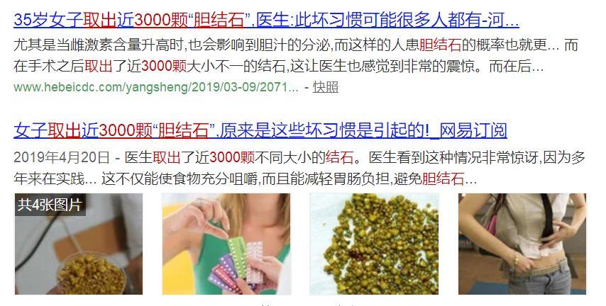 肚子疼有胀气有胆结石？胆石症腹痛如何治疗