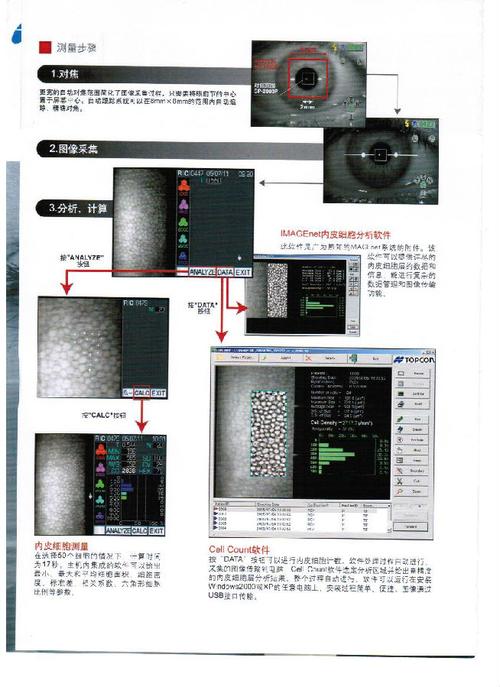 松下PLC KP怎么输入？（fuchs 角膜内皮营养不良）