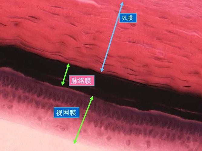 什么是脉络网？（营养视网膜外五层）