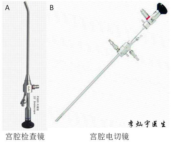 宫腔镜营养管（宫腔镜手术后营养）