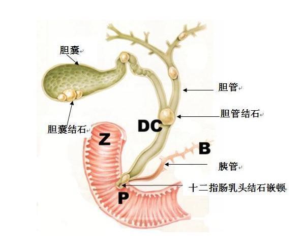 胆管梗阻营养获取（胆管的梗阻）