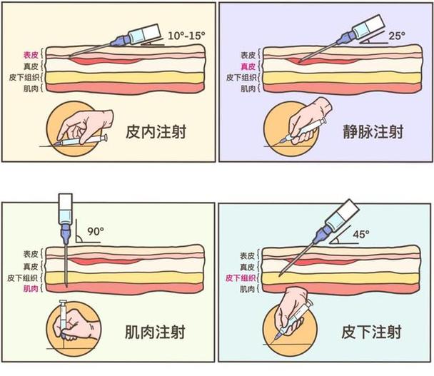 营养针打手臂还是屁股（营养针打手臂还是屁股好）