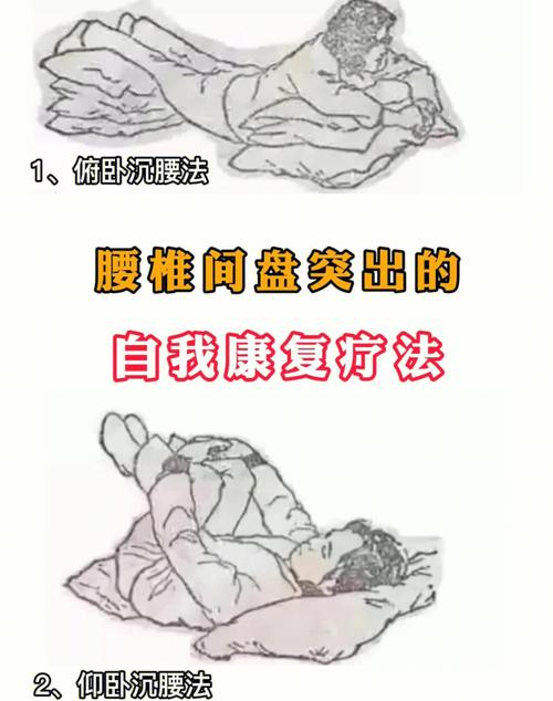 腰突出怎样营养治疗（腰突患者怎么才能养好呢）