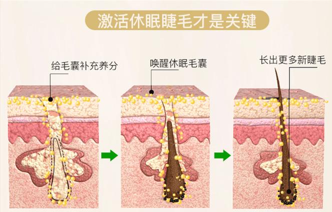 睫毛毛囊增加营养（睫毛毛囊是什么样子）